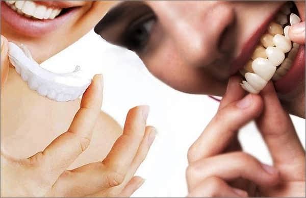 قیمت لمینت متحرک دندان در داروخانه یا دندانپزشکی کجا بخریم
